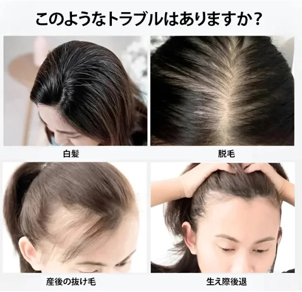 再発行片
