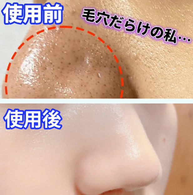 黒ずみ取りジェル