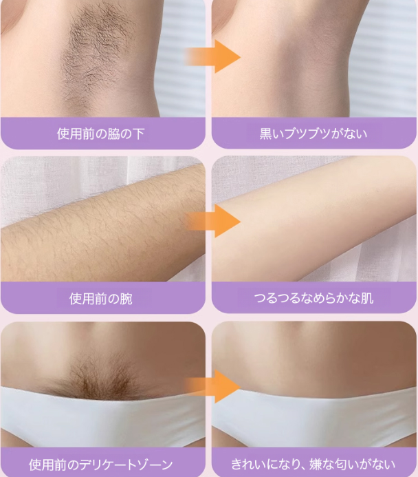 シェーパ