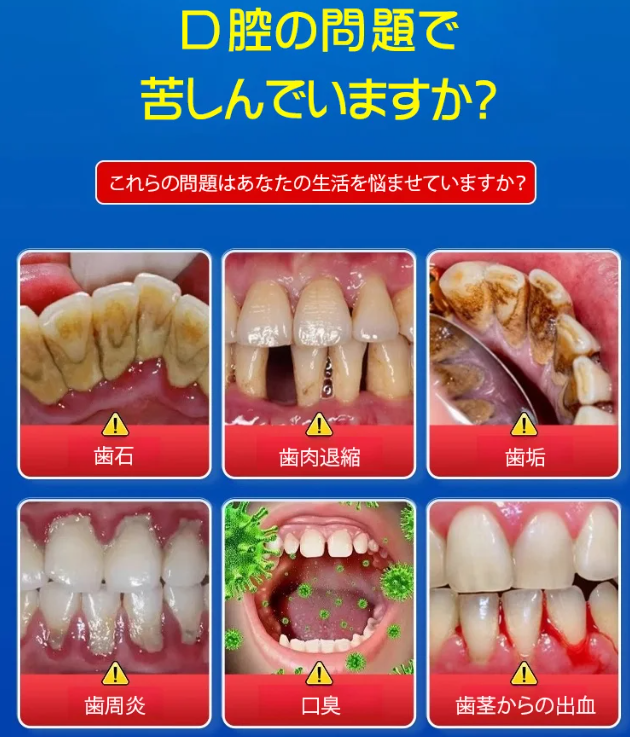 ぶんりざい