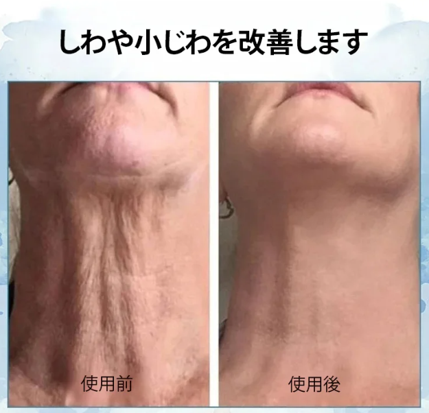 しわ取りクリーム