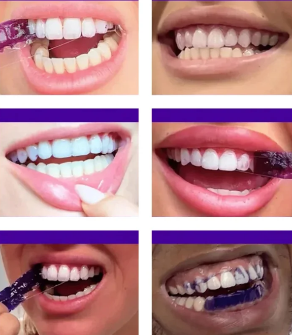 歯のホワイトニングシート