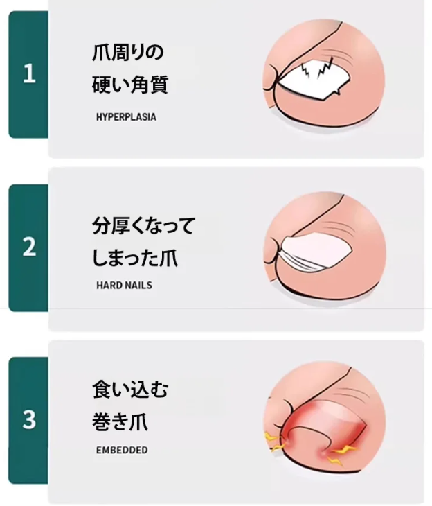 爪切り