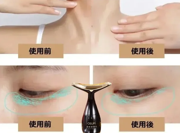 美顔器