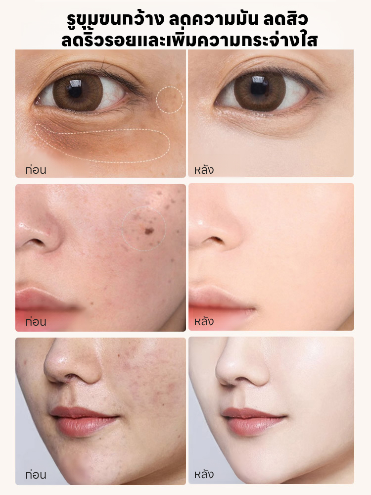 ✨🌟 ครีมบำรุงผิวหน้าสูตรขมิ้นธรรมชาติ – เพียงขวดเดียวแก้ปัญหาผิวหมองคล้ำและแห้งกร้าน!