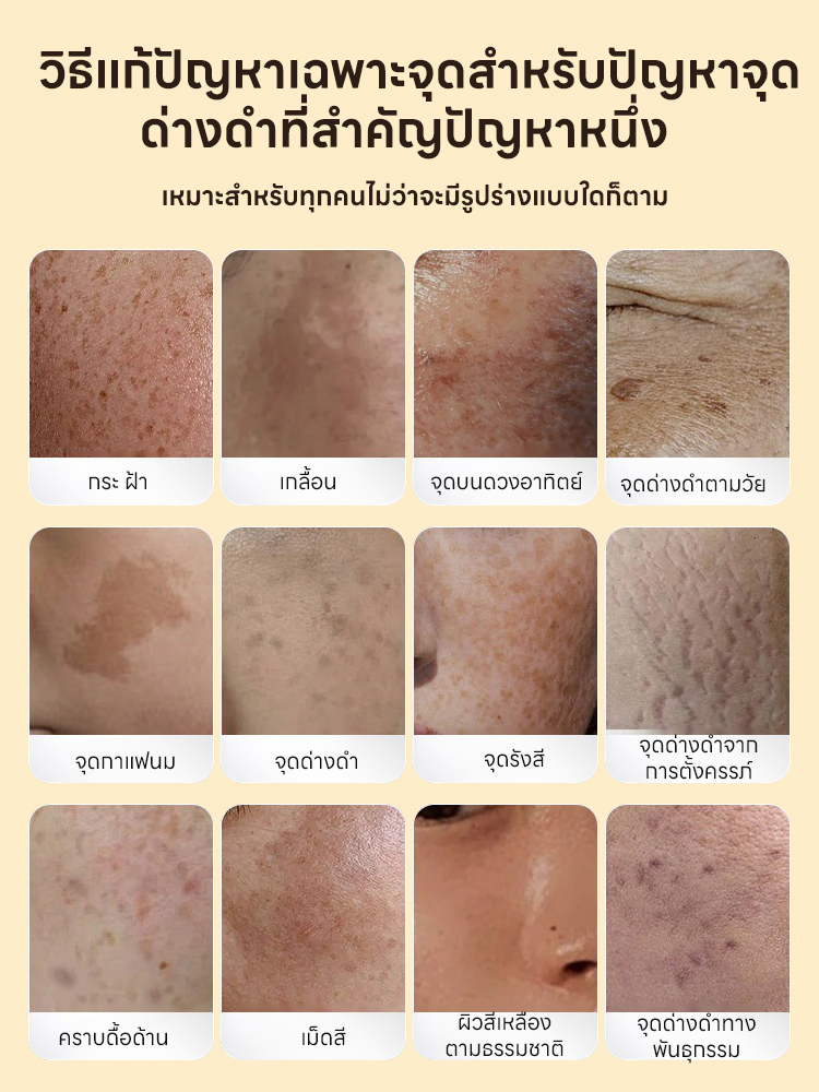 ✨🌟 ครีมบำรุงผิวหน้าสูตรขมิ้นธรรมชาติ – เพียงขวดเดียวแก้ปัญหาผิวหมองคล้ำและแห้งกร้าน!