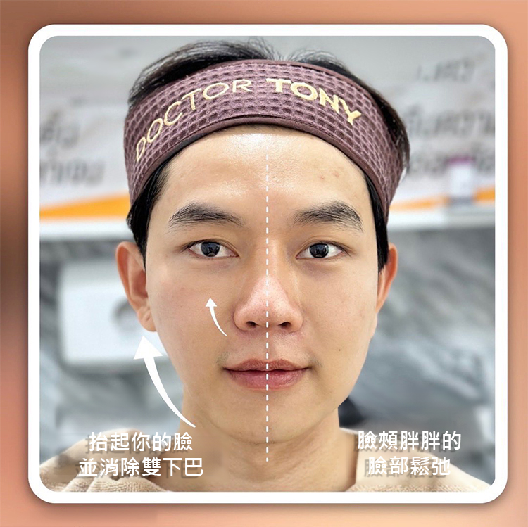 多肽針管填充膠原霜