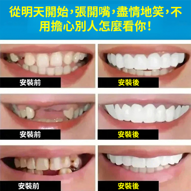 ORALHOE假牙修飾組（送牙膠）
