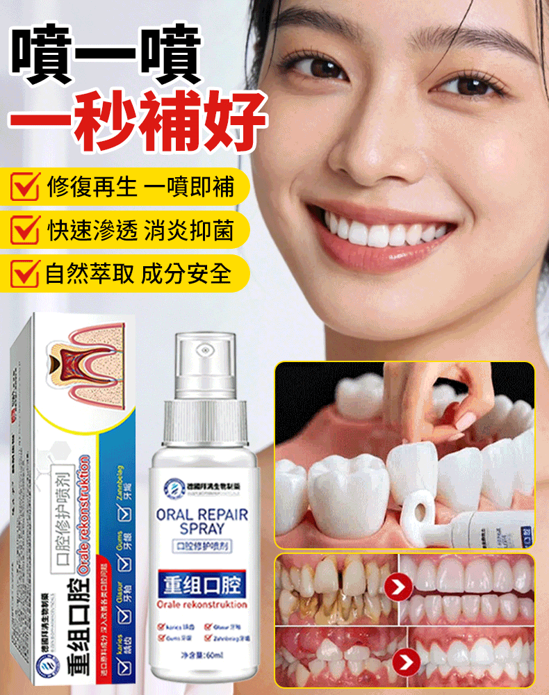 【牙齒不用補】牙齒重塑噴劑