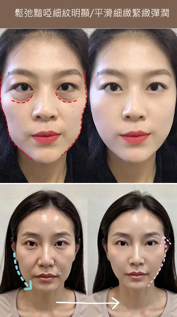 多肽針管填充膠原霜