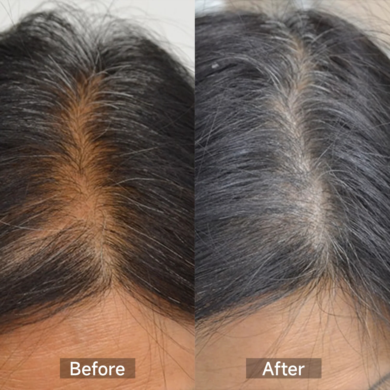 VeonSkin GrowMax Laser+LED Cap