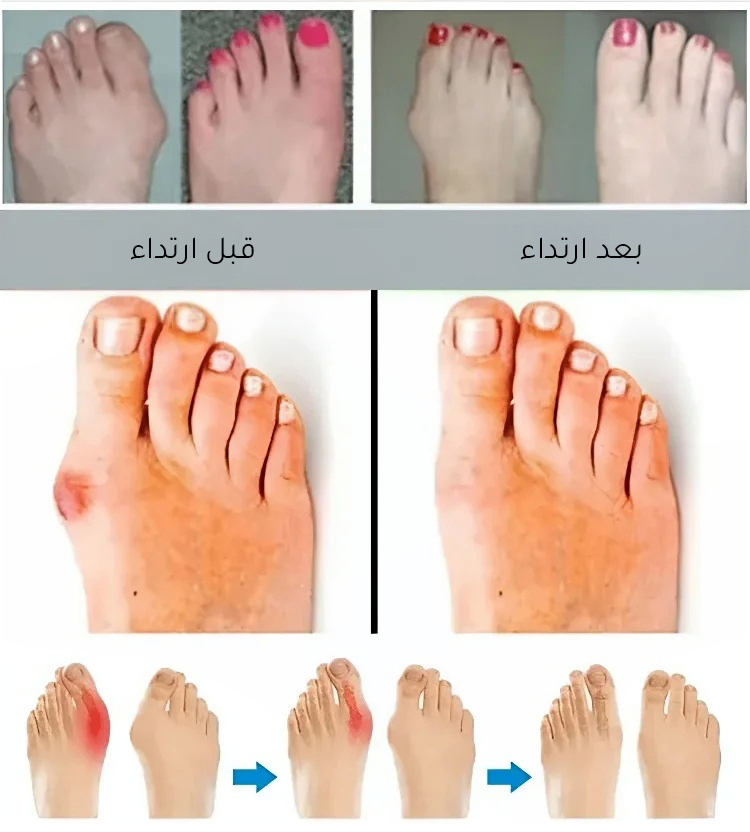 حذاء مريح للارتداء اليومي من الجلد الطبيعي