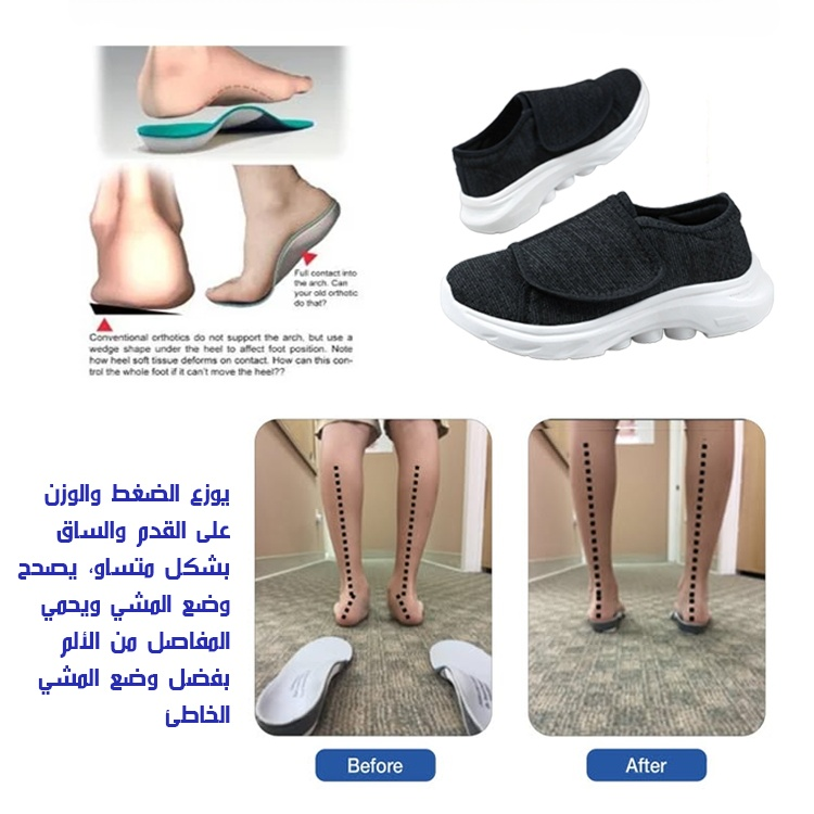 Healthy-foot   حذاء تصحيحي سهل الارتداء، مصمم بشريط سحري يسهل الارتداء والخلع ويمكن ضبط مدى ضيق الحذاء. مثالي بشكل خاص للأشخاص الذين يعانون من تورم القدمين أو التشوهات القدمية.  الحذاء ناعم وأنيق، مناسب للحوامل والمسنين ذوي الحركة المحدودة والأشخاص الذين -healthy-foot