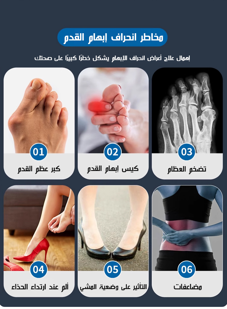 تصميم مبتكر لشبشب تقويم إبهام القدم