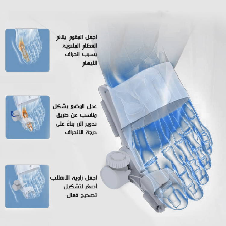 Healthy-foot مقوم انحراف أصابع القدم (تحسين الحالة في غضون 28 يوما)