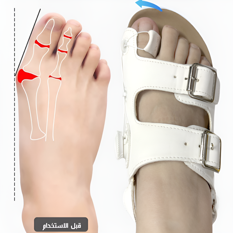 Healthy-foot أحذية نسائية لتصحيح بروز إبهام القدم. يمكن تعديل عرض وارتفاع الحذاء لتصحيح المشية. مناسب لمن يعانون من مشاكل في القدم أو من يحتاجون لجراحة في القدم-healthy-foot