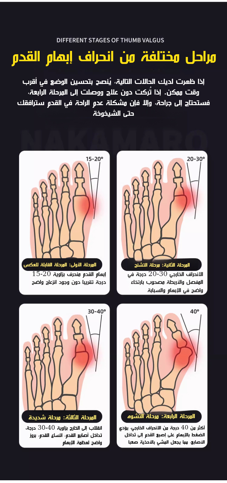 تقويم أصابع القدم وتحسين الراحة