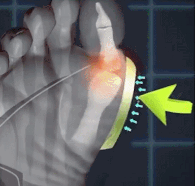 حذاء مارتين مع نعل متين لمنع الانزلاق