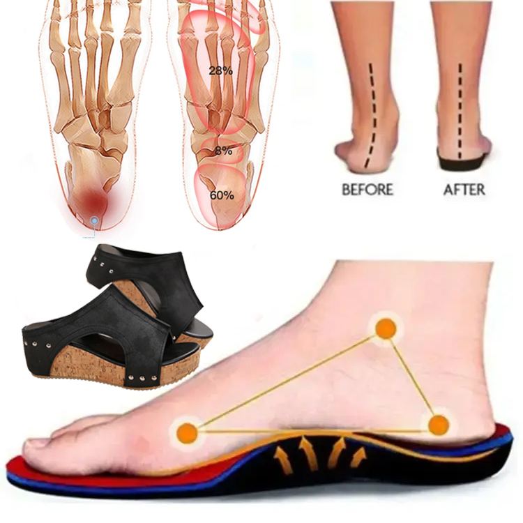 Healthy-foot صندل نسائي مفتوح من الأمام، بتصميم عربي عتيق، تصميم بسيط وأنيق، مناسب للارتداء اليومي-healthy-foot