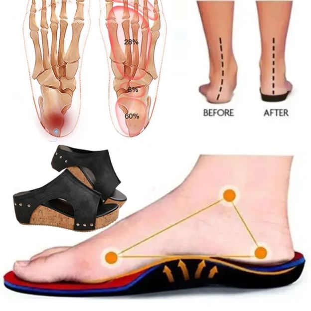 Healthy-foot صندل نسائي مفتوح من الأمام، بتصميم عربي عتيق، تصميم بسيط وأنيق، مناسب للارتداء اليومي-healthy-foot