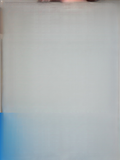 Smile Whitening Dentures