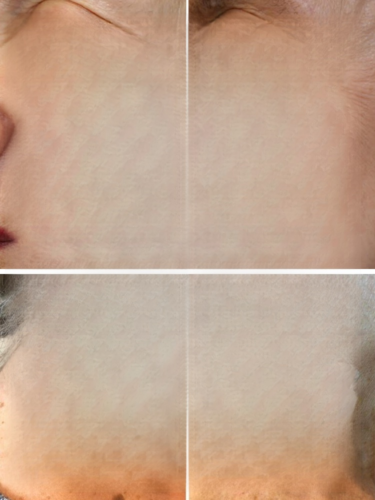 ✅ 100% natural formula：Non-irritating, pain-free, no residue – suitable for all skin types