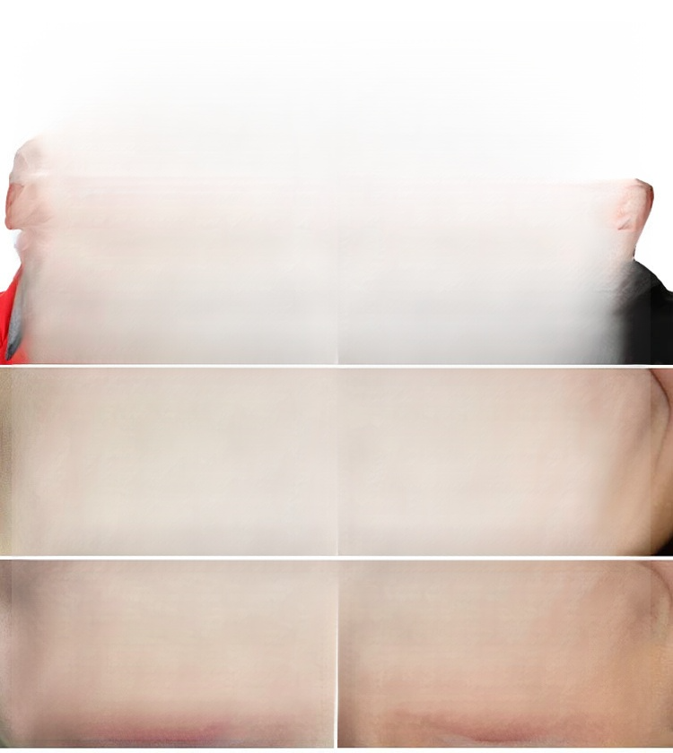 GELFIT™ Dental Cosmetic Denture Modification Kit