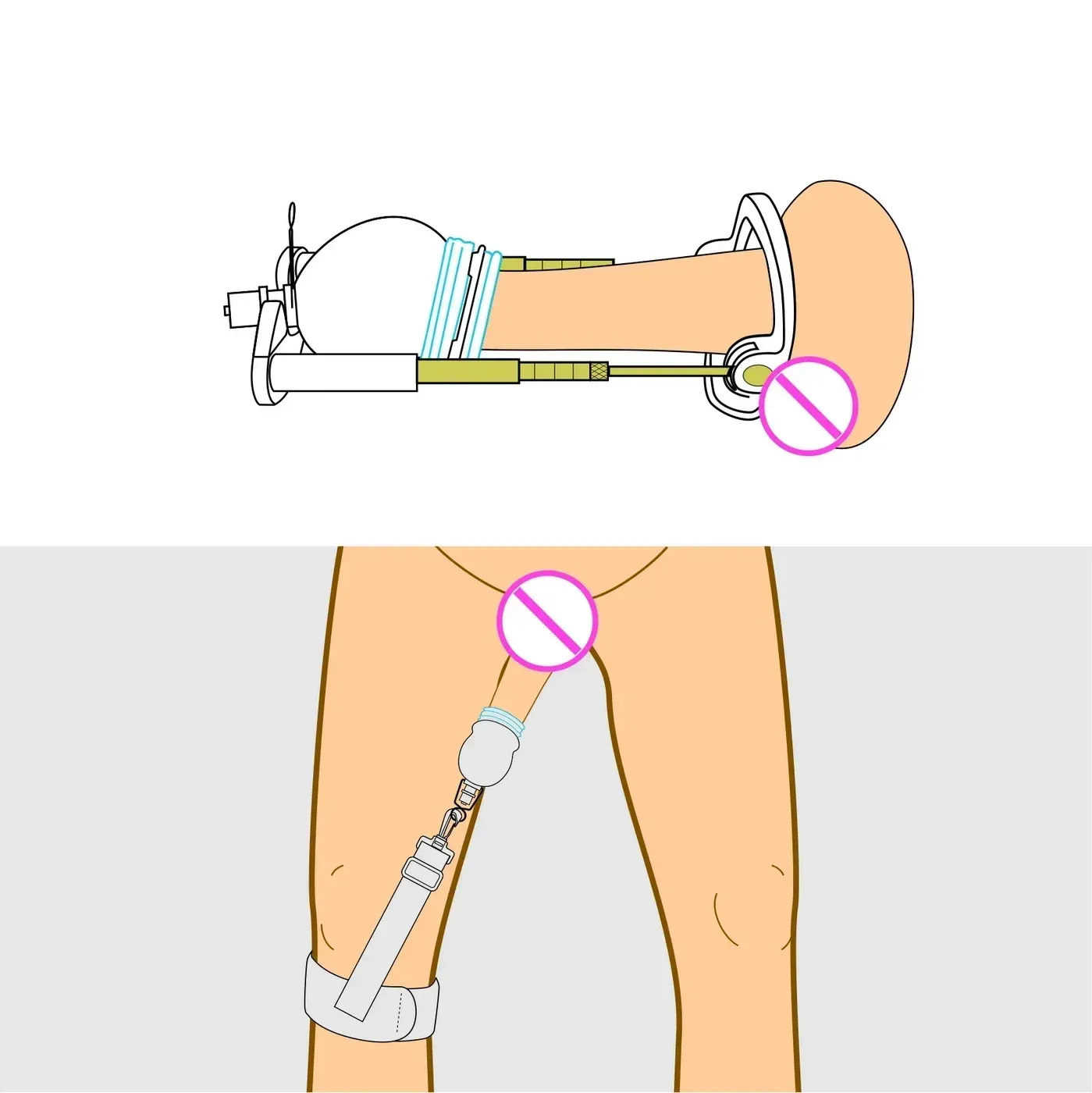 เครื่องยืดอวัยวะเพศชาย กระบอกเพิ่มขนาด ระบบยืด+แรงดันลบ ขยายขนาด