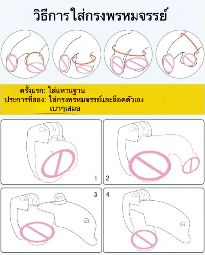 W6300未定价ล็อคท่อปัสสาวะ อุปกรณ์สำหรับผู้ชาย รูปทรงคล้ายฝาหม้อ กันการหลุดหนี ทำจากสแตนเลส