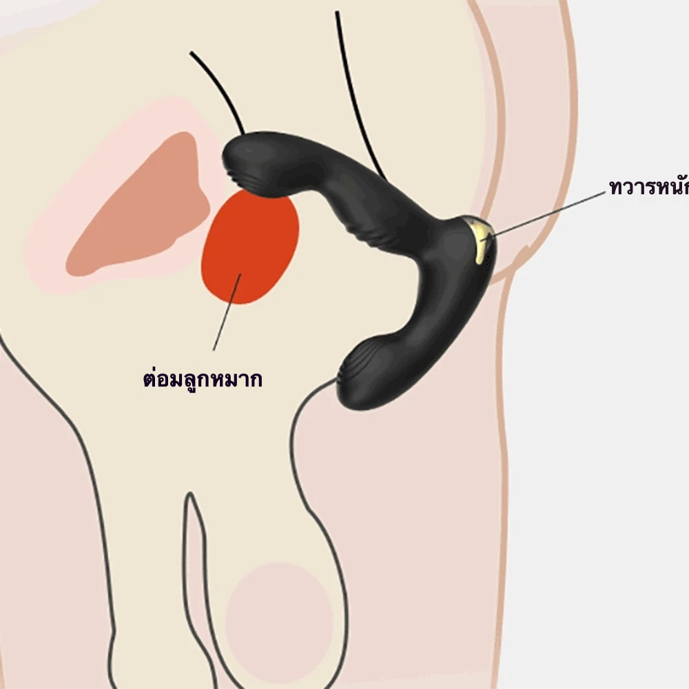 ต่อมลูกหมากเครื่องนวด มอเตอร์สั่นสะเทือนคู่ 10 ระดับความถี่ กดปุ่มเดียวถึงจุดสุดยอด ควบคุมรีโมทอินฟราเรด|LILO-sextoyfunny