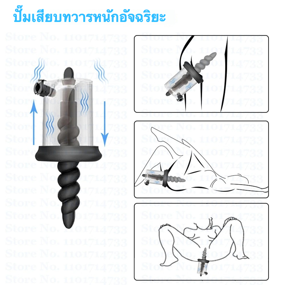 W0216 ต่อมลูกหมากเครื่องนวด ดูด+นวด ปั๊มไฟฟ้าอัจฉริยะ ความดันลบคงที่ ห่วงทวารหลายแบบ ถอดได้|PND
