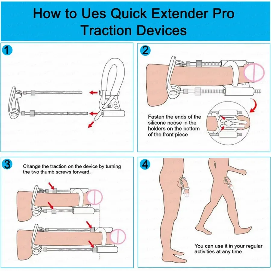 Adjustable Stretch Length Penis Stretcher 3 Styles Available