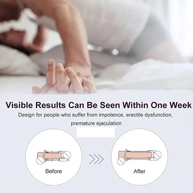 Adjustable Stretch Length Penis Stretcher 3 Styles Available