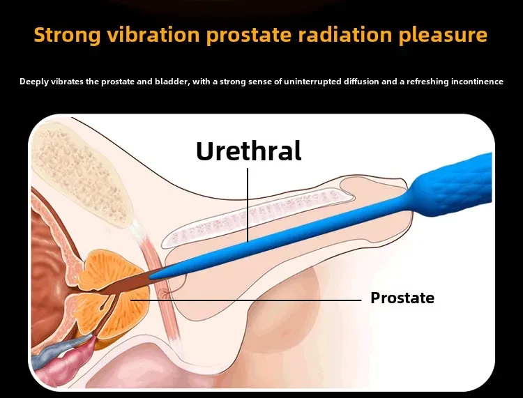 7 Frequencies, 3 Intensity Levels Silicone Urethral Sound