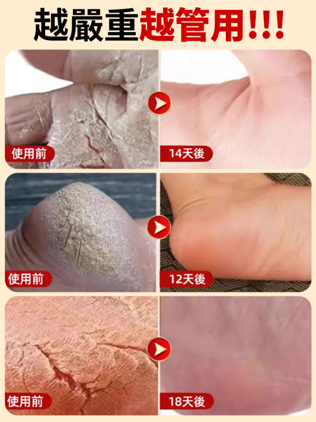 【99.99% 水潤度暴增💧】膠原蛋白維C護手霜❤台湾熱賣破 15 萬件！專治手部所有困擾