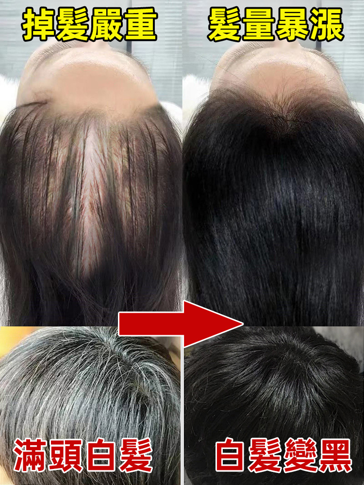 【0化學成分】黑髮17種植草本洗髮粉，白髮轉黑 7 天長新髮🔥止掉髮 + 控油去屑