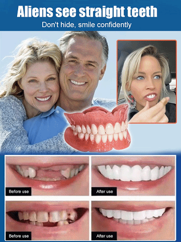  ❤ 😍No glue required, installs in 1 second. Perfectly fits your mouth. Whether you have a full set of teeth, partially missing teeth, or no teeth at all, they'll fit perfectly.