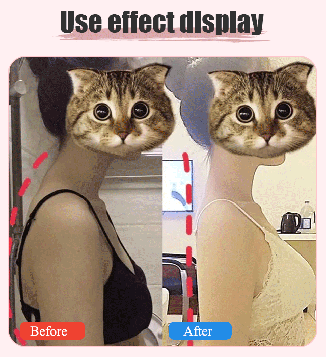 Get Supermodel Posture! ✨ Get Your Posture Corrector Stick Now For The Price Of A Meal! 💃