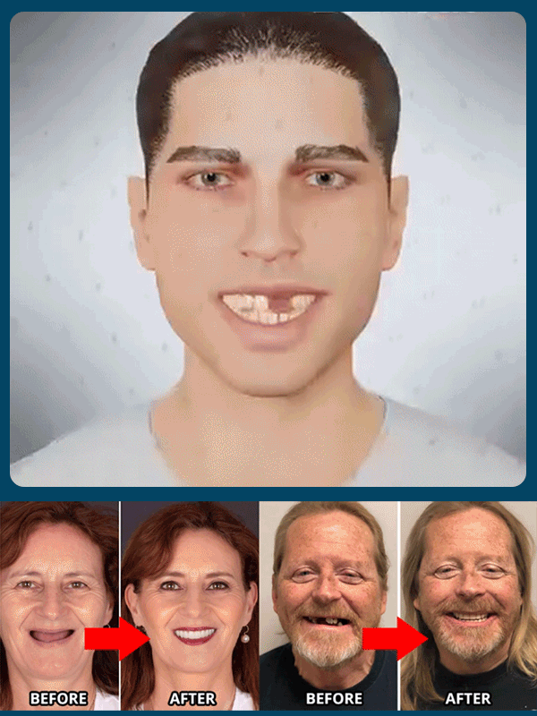  ❤ 😍No glue required, installs in 1 second. Perfectly fits your mouth. Whether you have a full set of teeth, partially missing teeth, or no teeth at all, they'll fit perfectly.