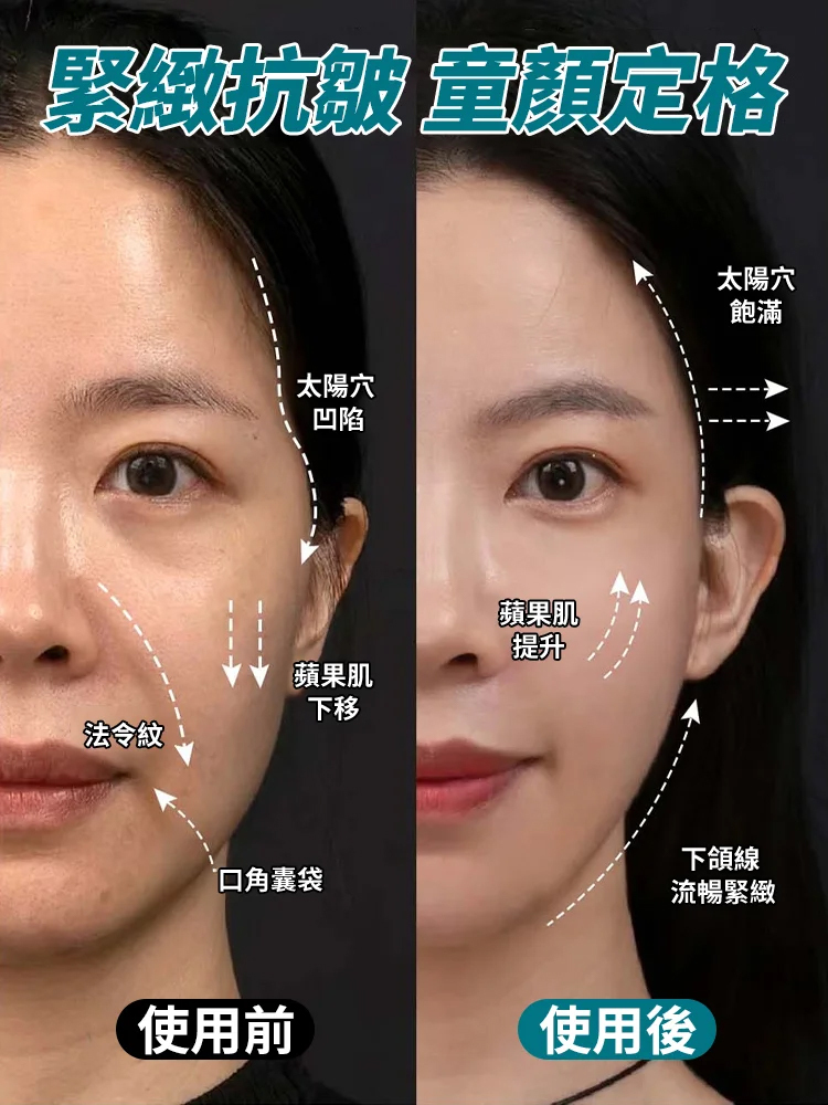 【一貼見效】377美白抗皺祛斑面膜