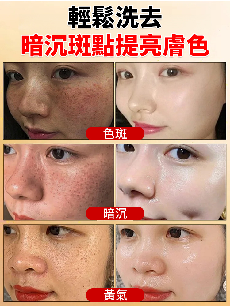 【專抹頑固斑點】升級版祛斑精華油