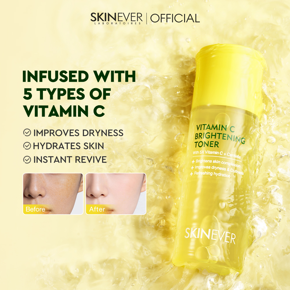 Vitamin C Brightening Toner-SKINEVER PH