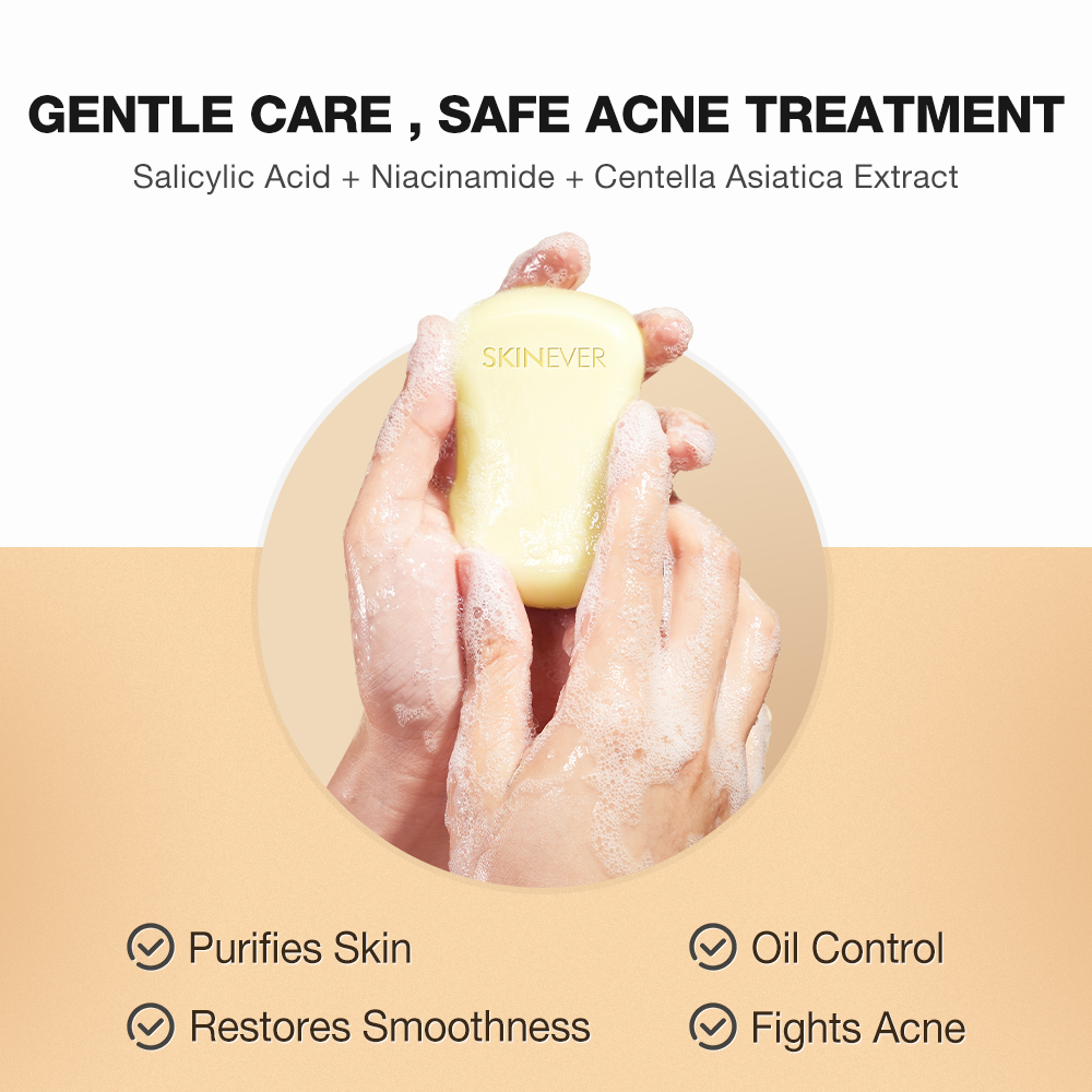 Full Acne & Whitening Therapy Kit-SKINEVER PH