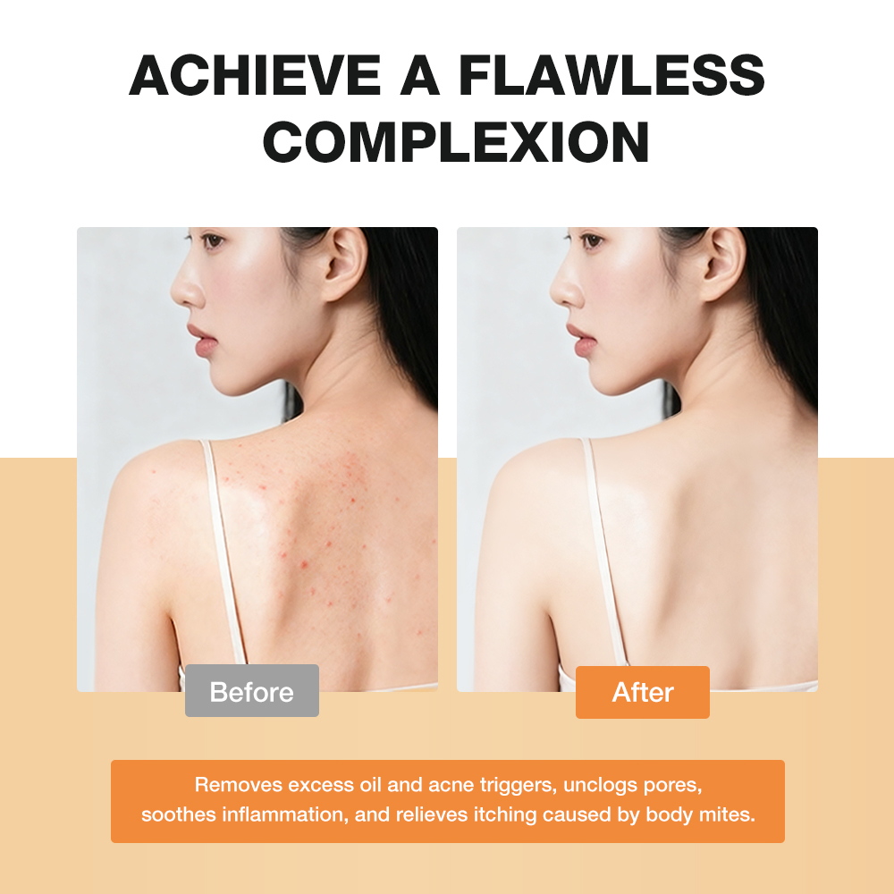 Salicylic Acid Refreshing Acne Skin Body Wash-SKINEVER PH