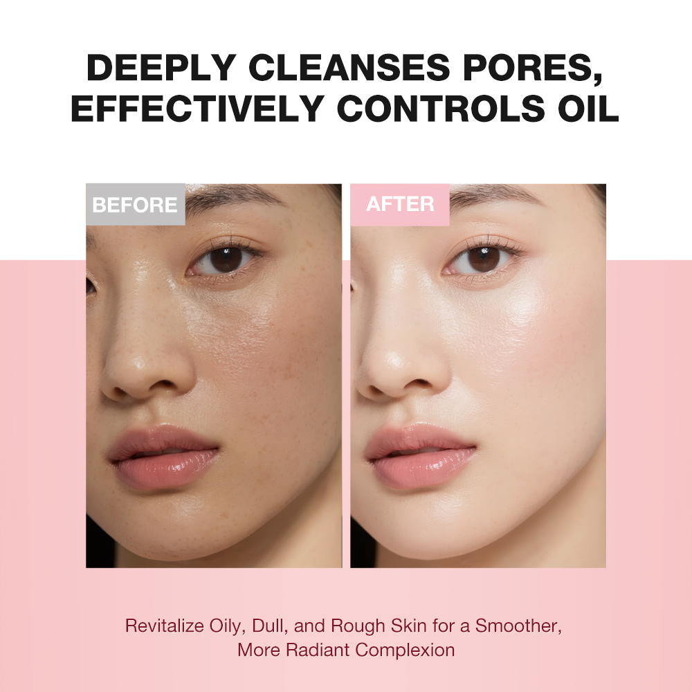 Niacinamide Brightening Scrub Cleanser-SKINEVER PH