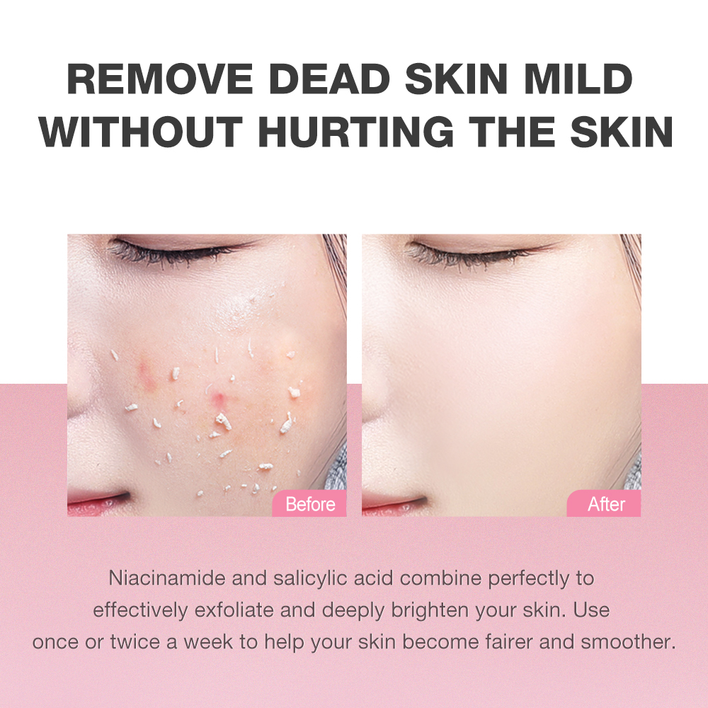 Full Acne & Whitening Therapy Kit-SKINEVER PH