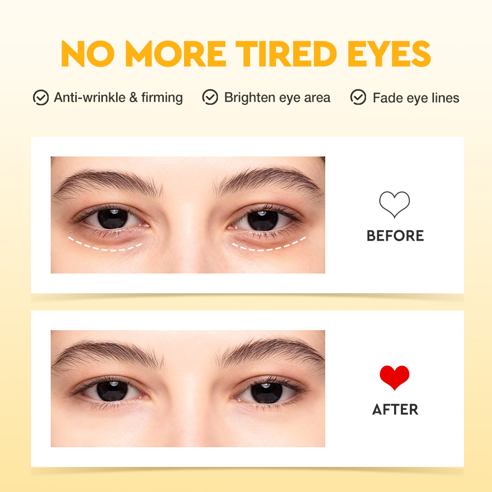 5X Vitamin C Eye Cream-SKINEVER PH