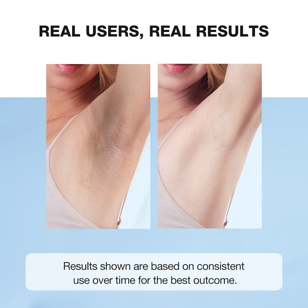 Deodorant Brightening Underarm Cream-SKINEVER PH