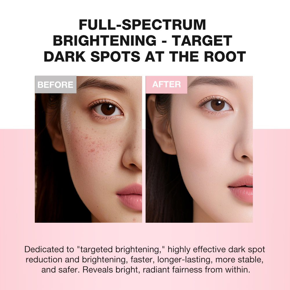 Niacinamide Brightening&Whitening Set-SKINEVER PH