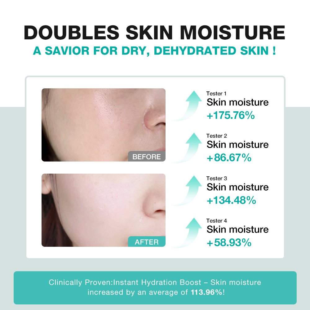 Centella Soothing Set-SKINEVER PH